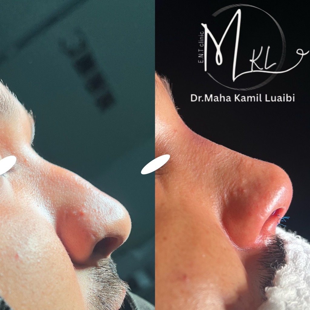 Maha Luaibi — الأنف والأذن والحنجرة