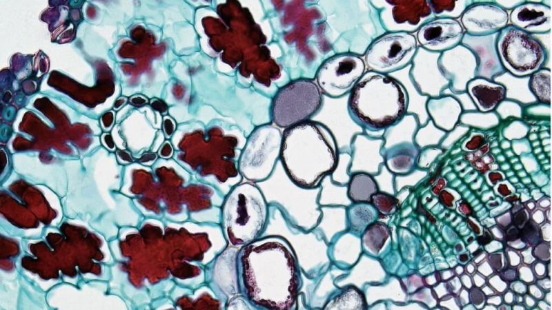 AI Finds the Hidden Cells That May Help Cancer Return