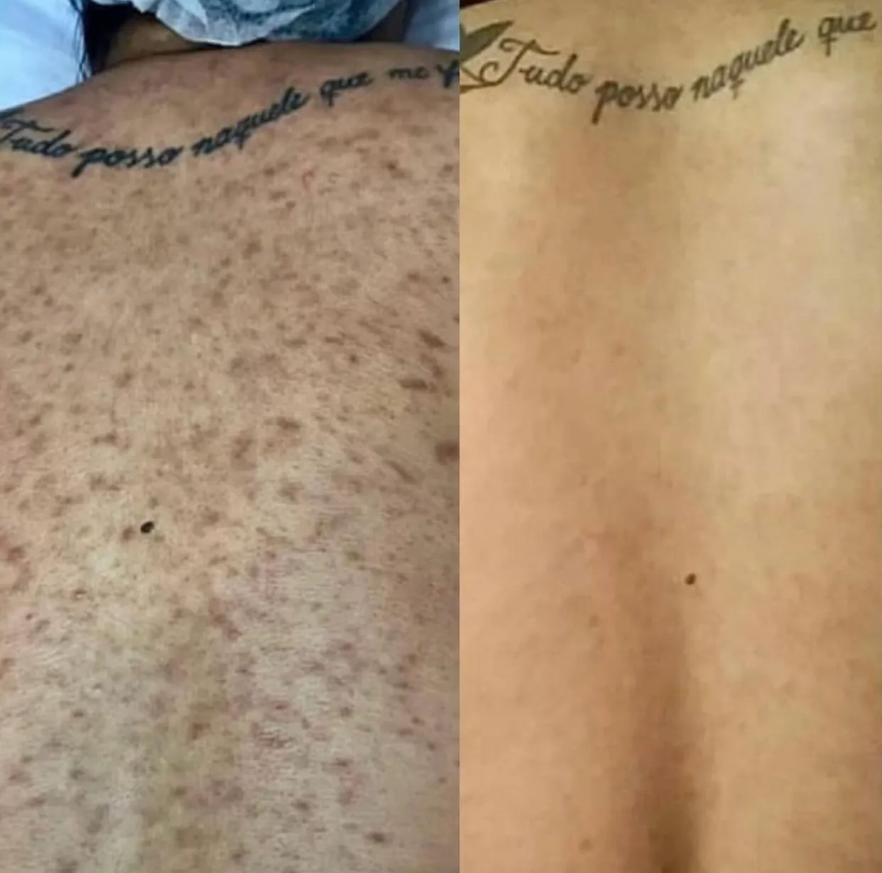 خدمات زیبایی beauty touch clinic