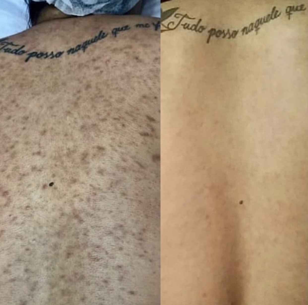 خدمات زیبایی beauty touch clinic