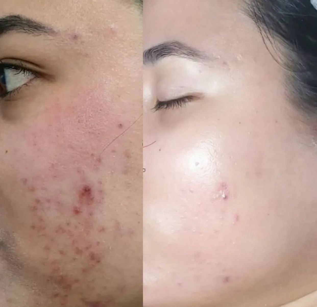 خدمات زیبایی beauty touch clinic