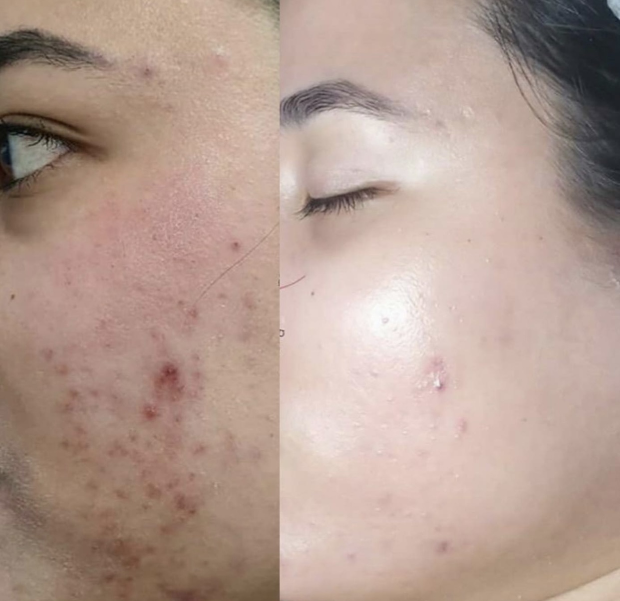 خدمات زیبایی beauty touch clinic