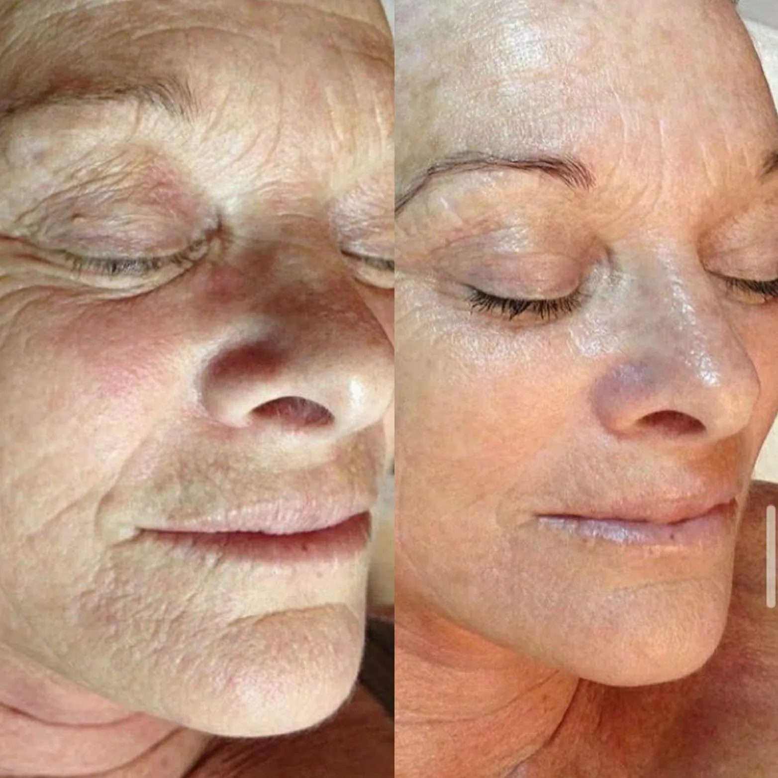 خدمات زیبایی beauty touch clinic