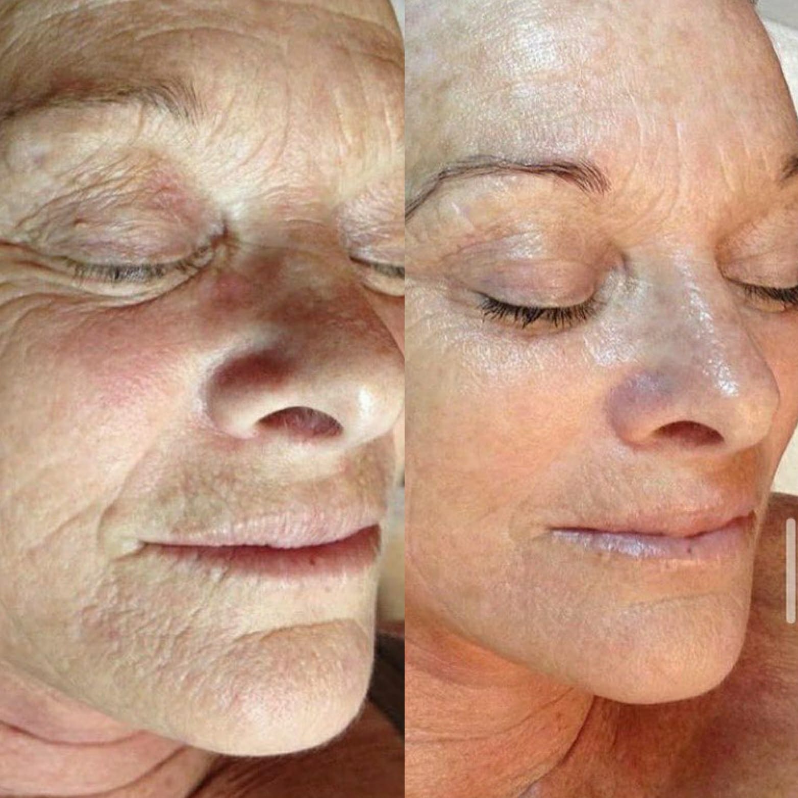 خدمات زیبایی beauty touch clinic