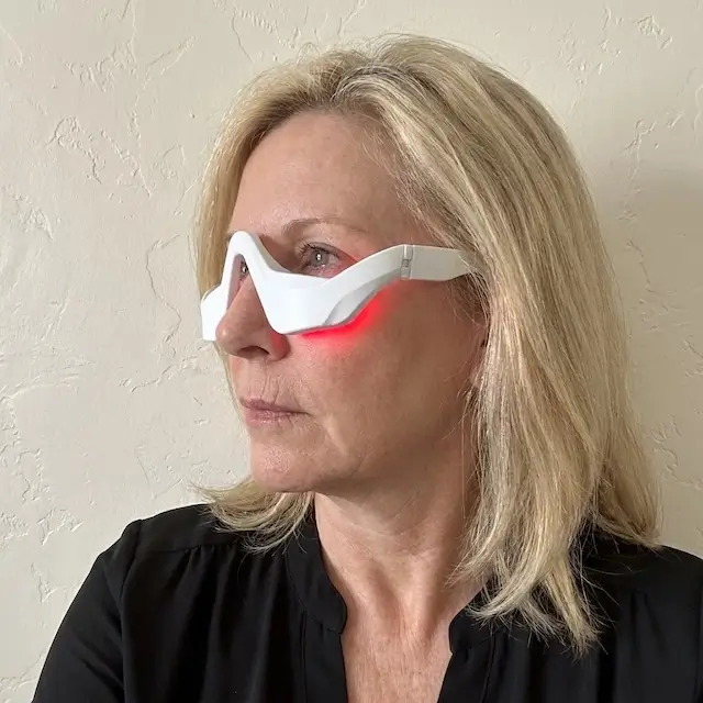 Sophie — cernes réduits après 3D Eye Beauty™