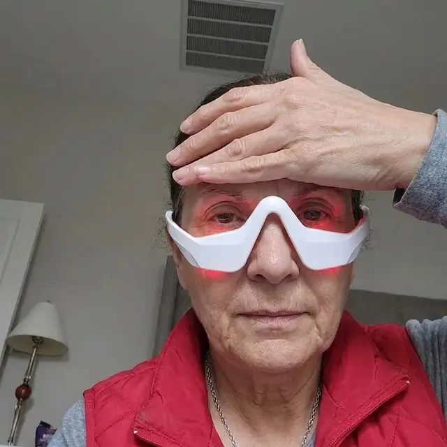 Isabelle — résultats de la luminothérapie rouge autour des yeux