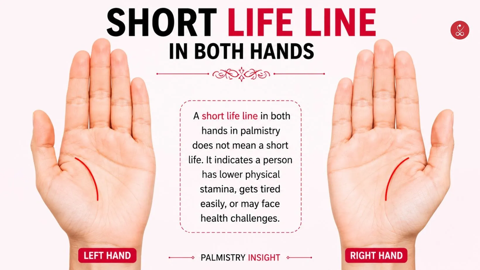 short life line in both hands