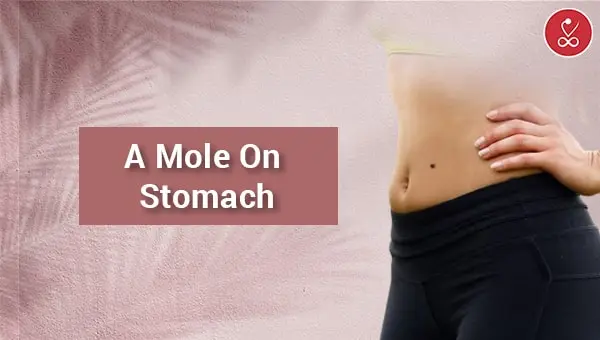 Mole on Stomach