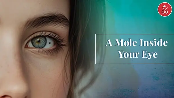 Mole Inside Your Eyes