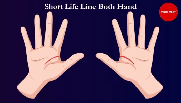 Short Life Line in both hands