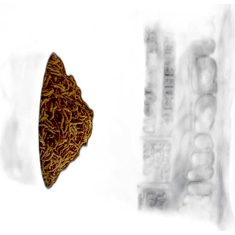 MADMIX MILLET BHUJIA MASALA MASTI 27GMS