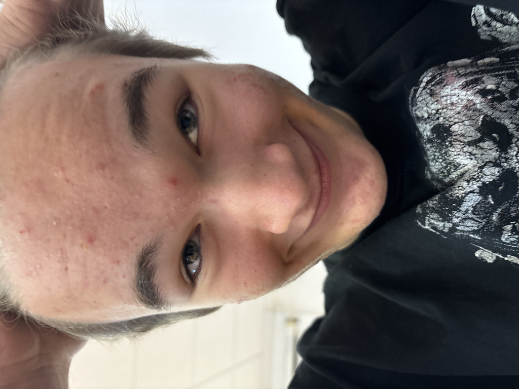 @eliastheguy from Czech Republic
