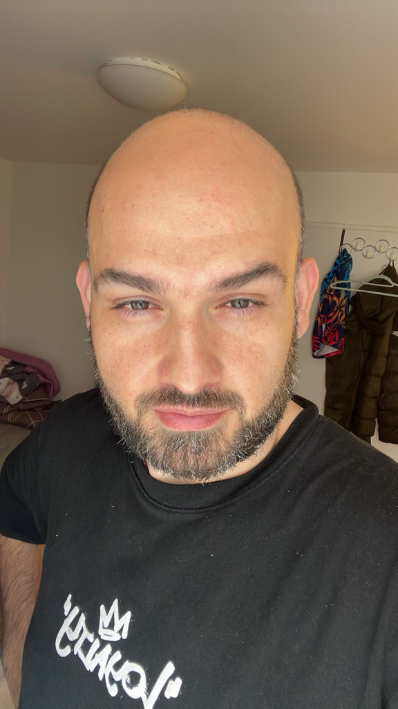 @reddotte39 from Switzerland