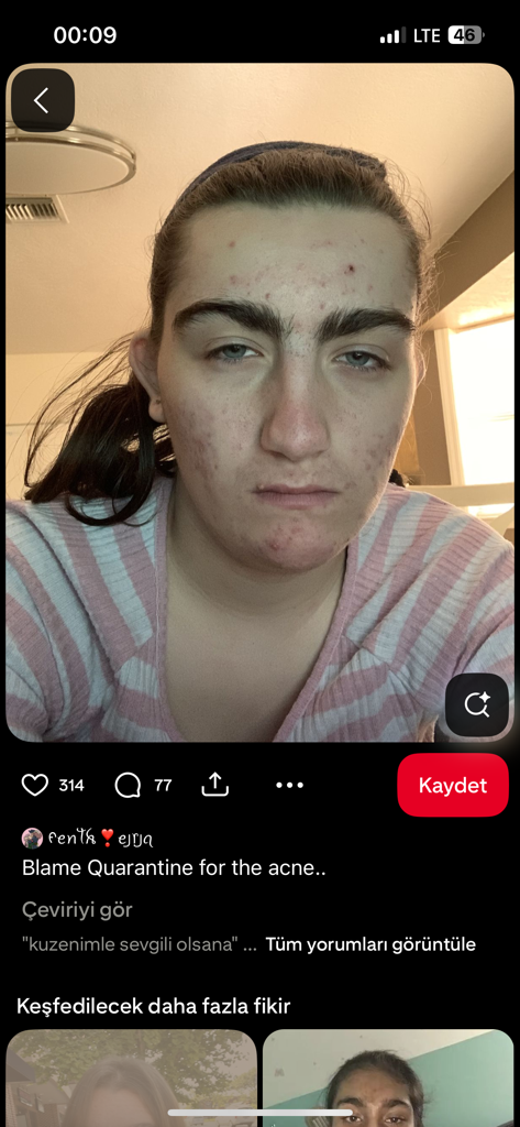 @u22817276 from Turkey