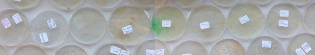 Bacteriën zijn overal