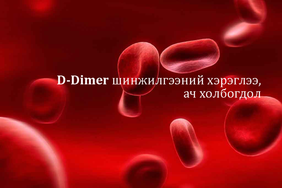 Д-даймер (D-Dimer) шинжилгээний эмнэлзүйн хэрэглээ, ач холбогдол