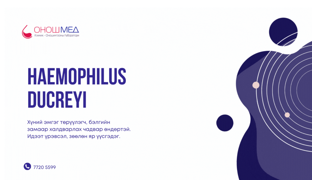 Haemophilus ducreyi