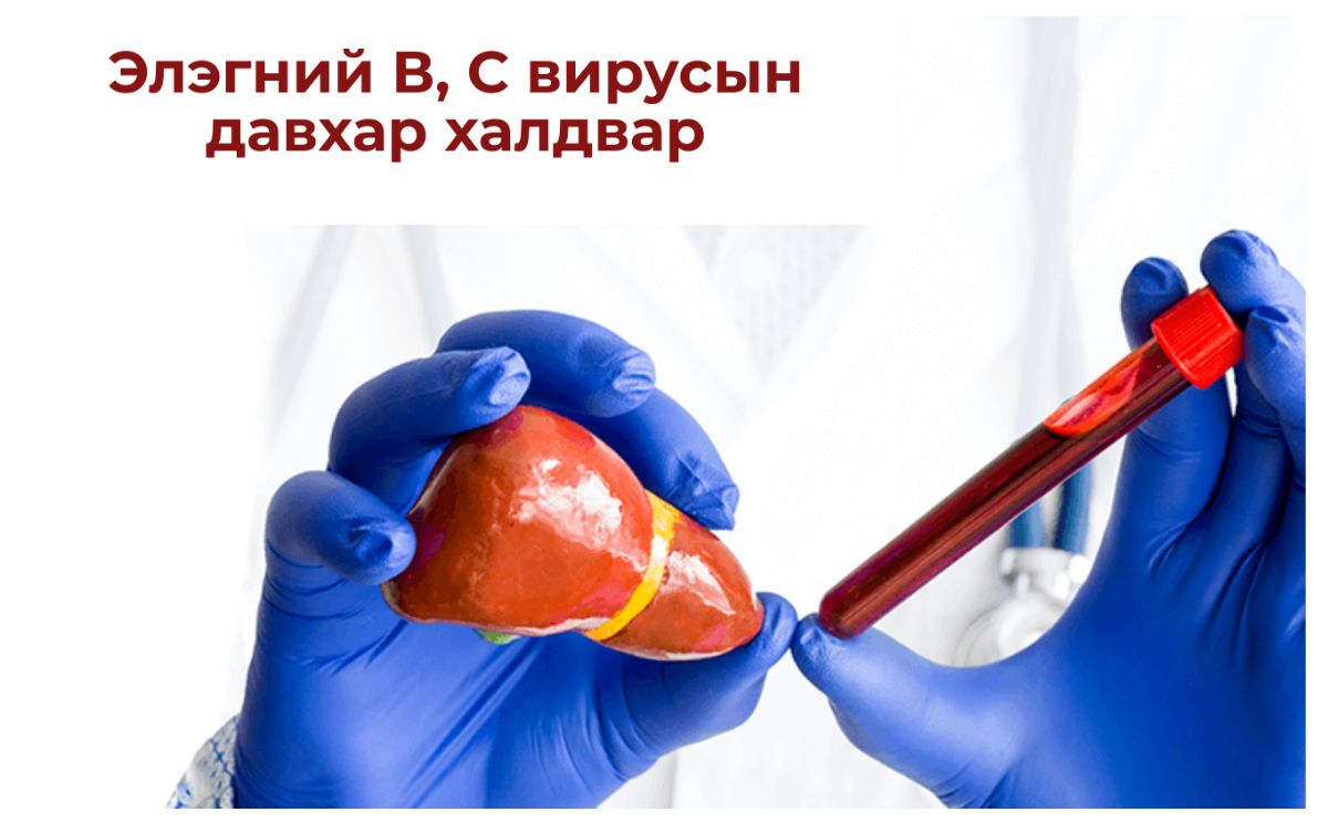 HBV, HCV давхар халдвар