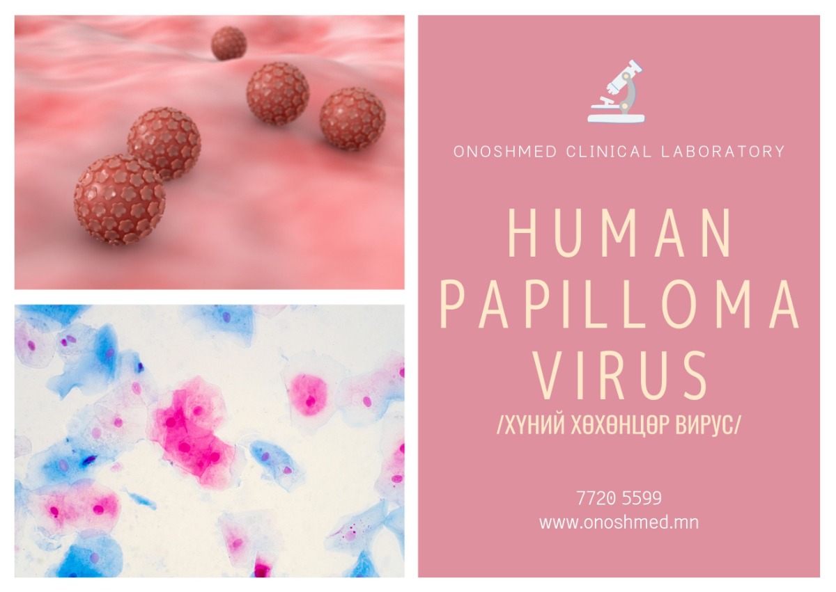 Human papillomavirus /HPV/