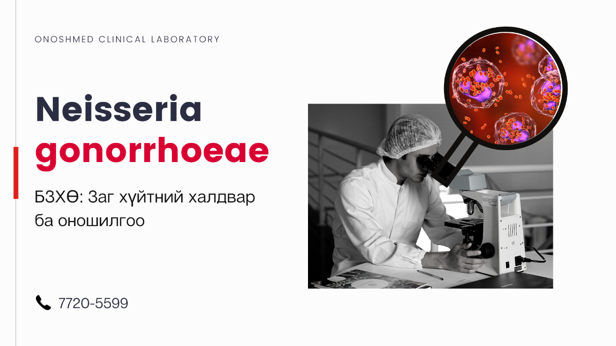 Neisseria gonorrhoeae