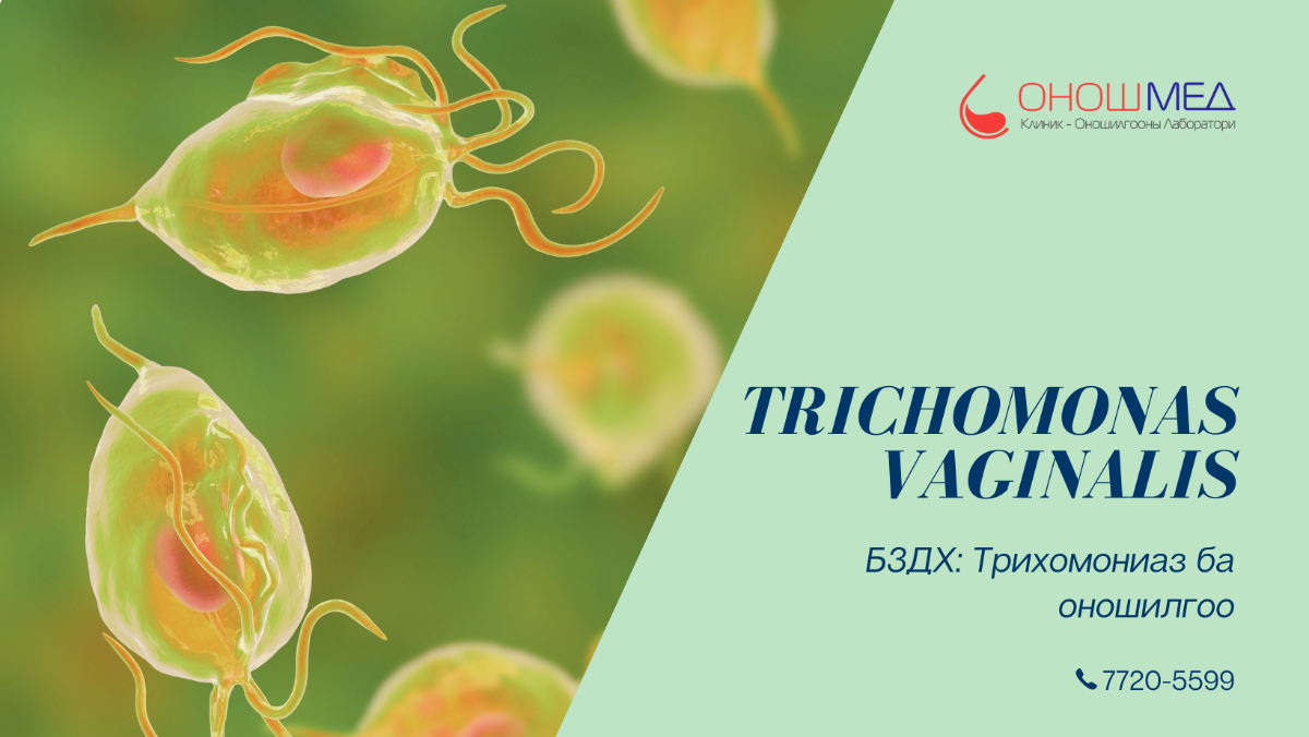 Trichomonas vaginalis