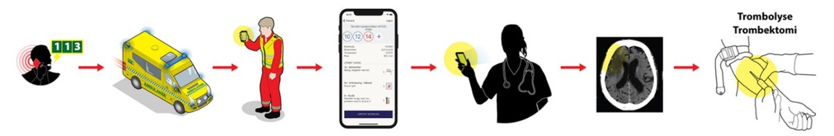 Slaget om hjernen: en pasientreise gjennom behandlingssløyfen