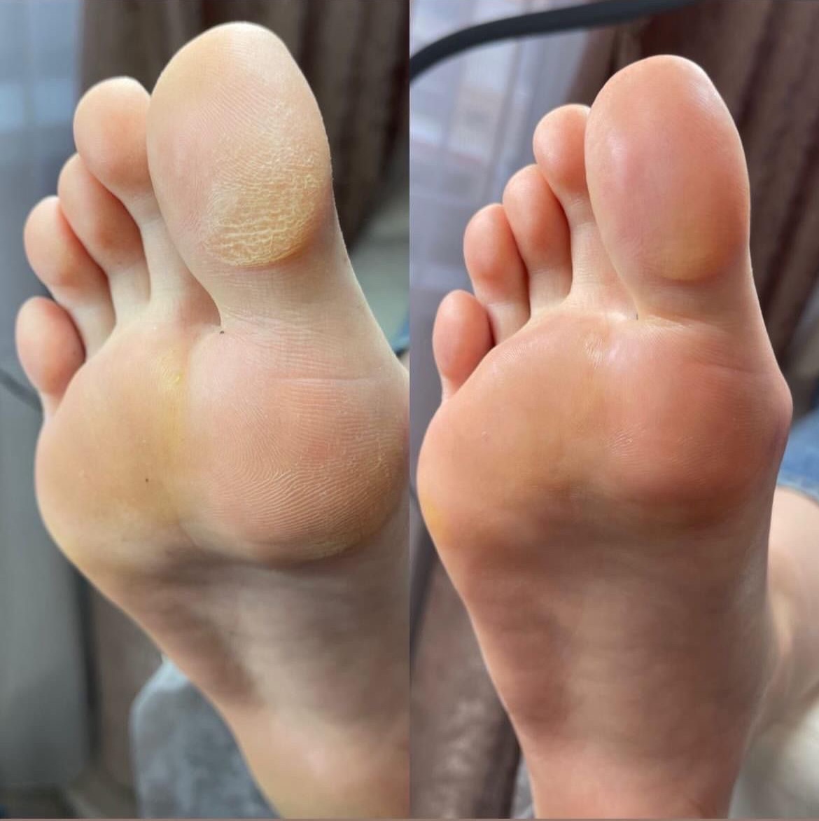 PÉDICURE RUSSE + GEL + SOIN DES CALLOSITÉS