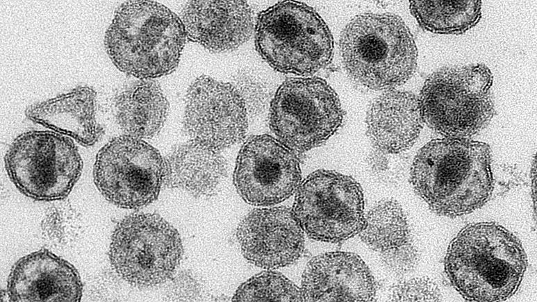 Bağırsak Bakterileri Cilt Kanseri Nüks Riskini Belirleyebilir