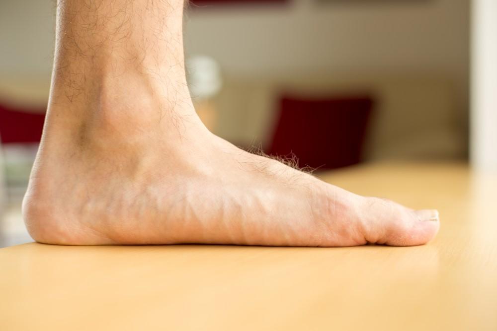 Flat feet