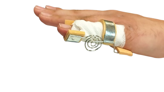 Dynamic Finger Flexion Splint image 4