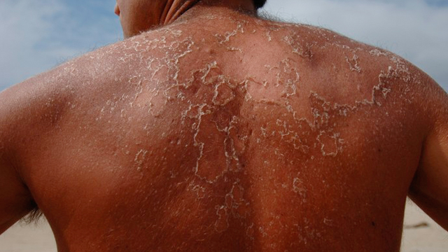 Bahia terá calor acima de 41°C e baixa umidade do ar