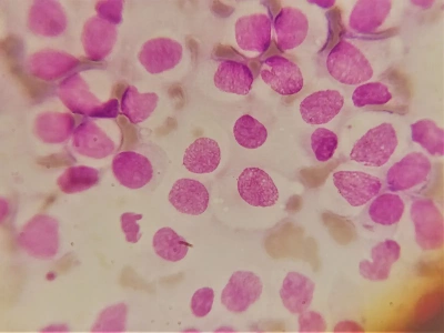 🔬 Цитологія — швидкий та інформативний метод діагностики