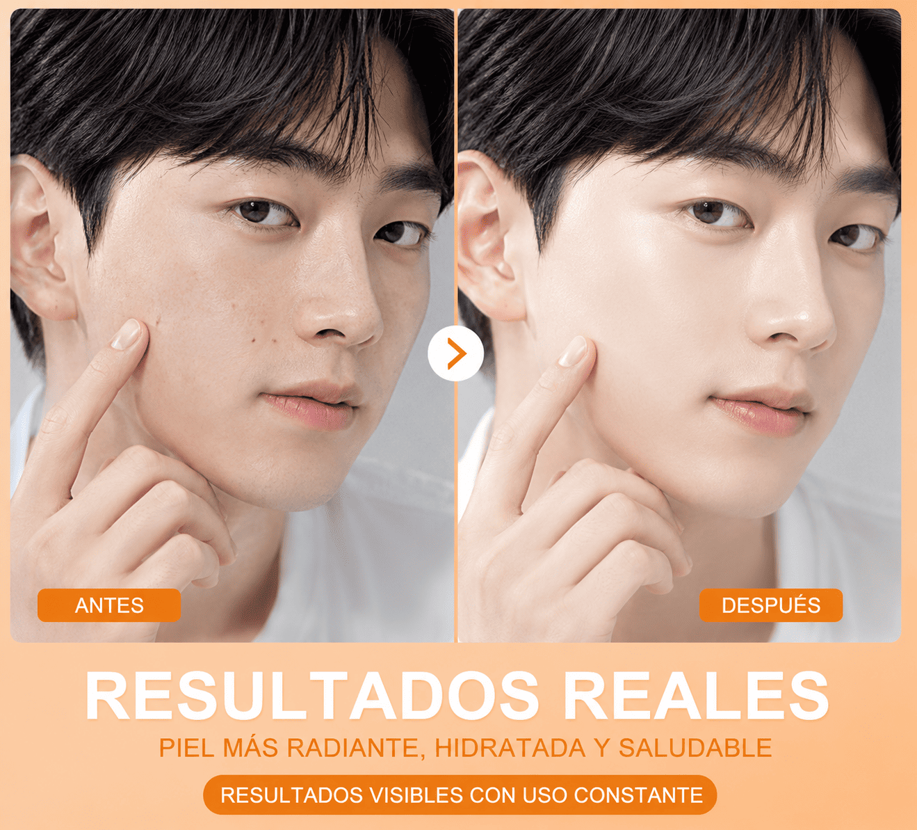 Locion coreana para acne thumbnail