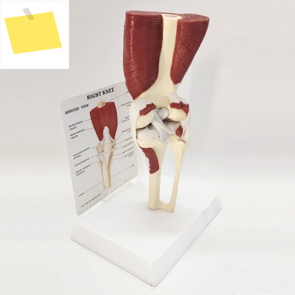 하이 퀄리티 무릎 관절 인대 운동 기능 모델 제품 이미지