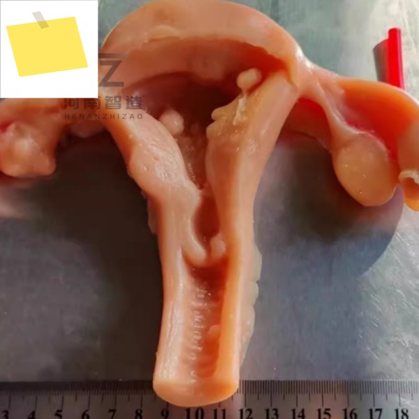 3D 생체모방 모듈, 부인과 복강경 절단 봉합 연습용, 자궁 실리콘 모델 제품 이미지