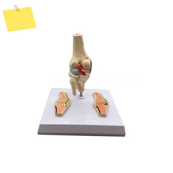 풍온 관절염 모델 생물학 교육 기본 의사-환자 커뮤니케이션 ZM2085 제품 이미지