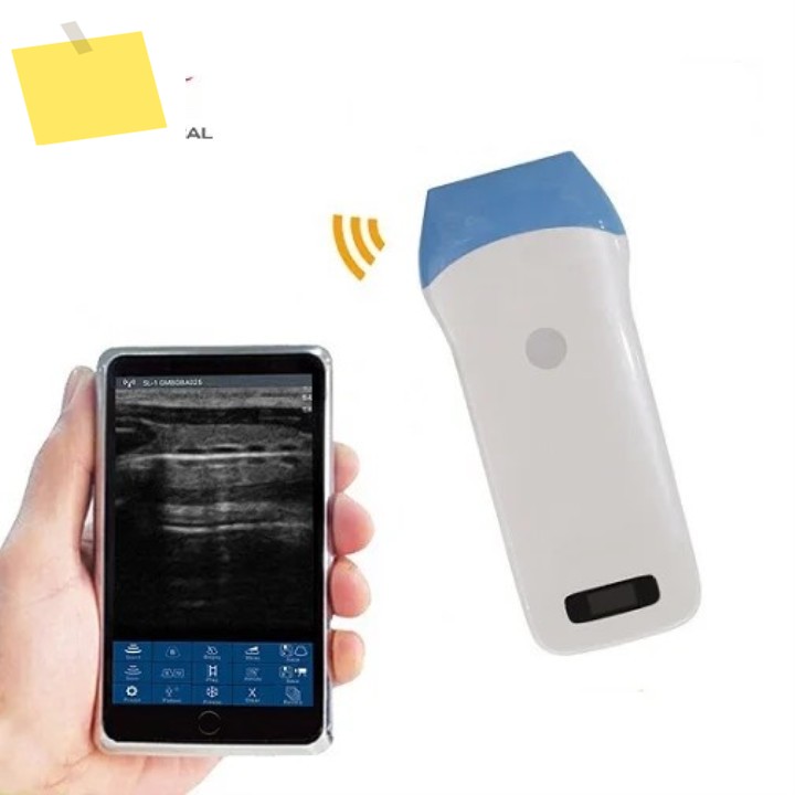 2025.4 안드로이드 및 IOS 윈도우용 4G5G Wifi 휴대용 128 요소 선형 프로브 무선 초음파 USG 제품 이미지