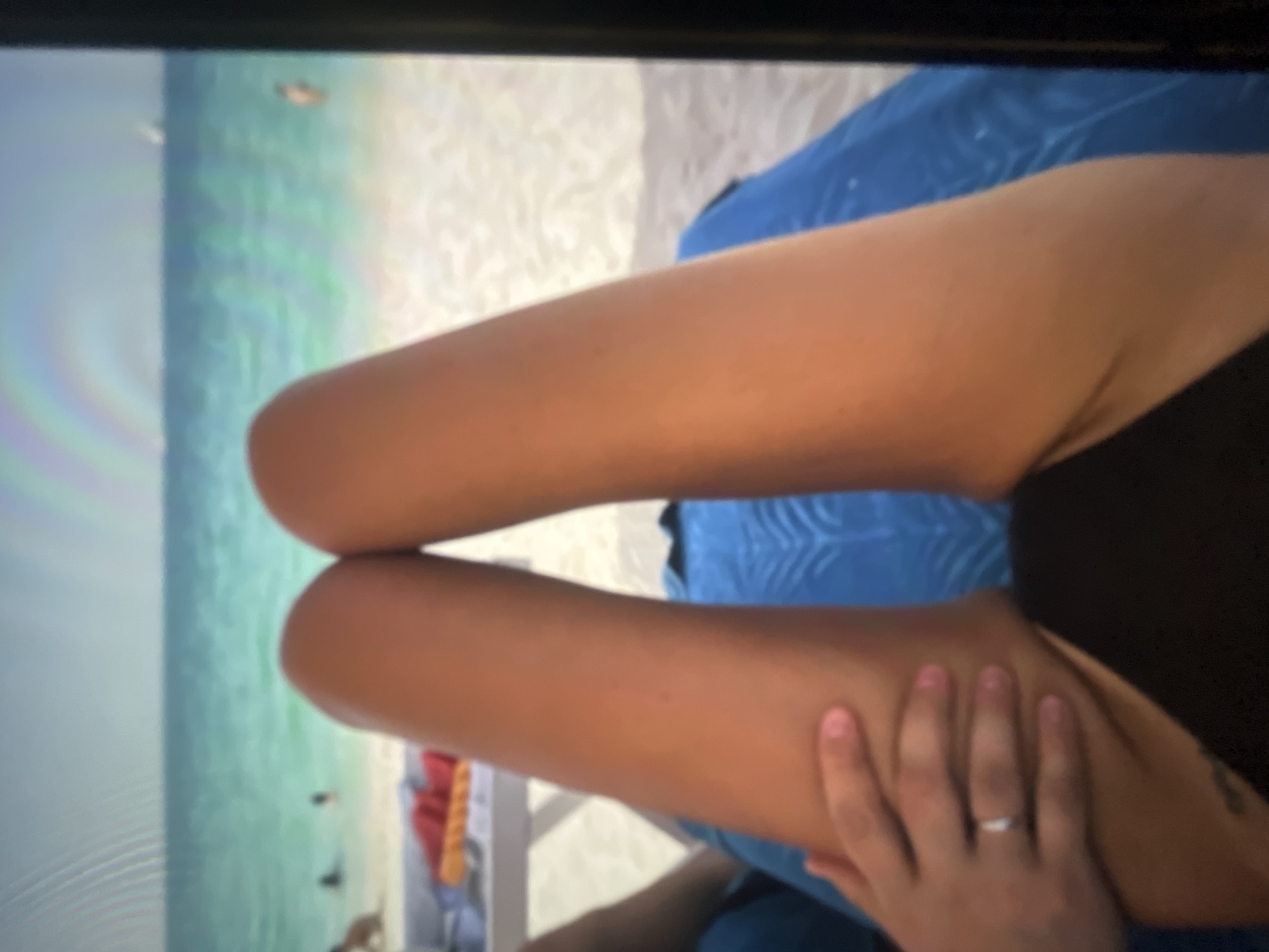 The image shows a person's legs and torso, lying on a blue towel on a beach. In the background, there is the ocean and a sandy beach with a few people. The scene appears to be a vacation setting. However, the provided location of Ravno pole, Bulgaria, is not an area known for its beaches and ocean.