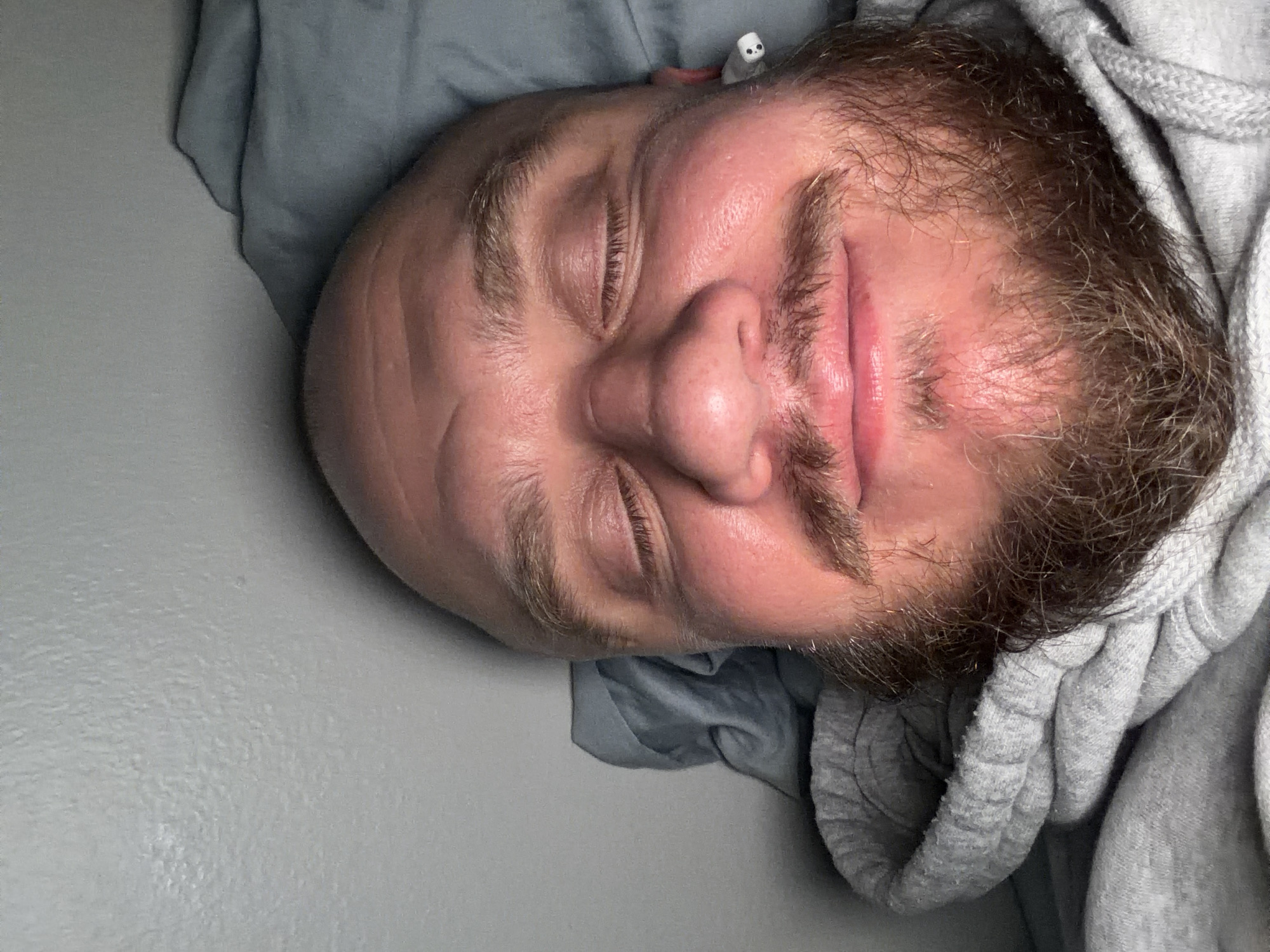 A close-up, upside-down photograph depicts a man with fair skin, a bald head, a full brown beard, and closed eyes, suggesting sleep. He is lying on what appears to be a grey bedsheet, with part of a grey hooded sweatshirt visible around his face. An electronic device, possibly an earbud, is seen near his right ear. The background is a plain light grey wall. The location is unknown, but given the query's inclusion of Morton Grove, United States of America, it is presumed the photo was taken there, although there is no visible evidence in the image to confirm it.