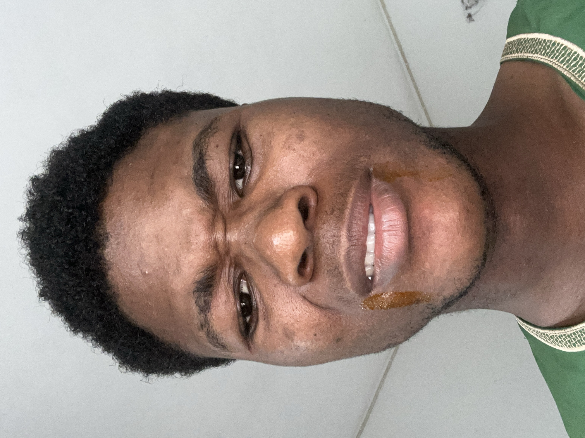 The image is a close-up, low-angle, headshot of a young Black male. He has short, dark, curly hair and is making a disgusted or displeased facial expression with furrowed brows and wrinkled nose. There is a streak of a dark, viscous substance running down the left side of his chin. He is wearing a green garment with a gold embroidered trim. The background appears to be a plain, light-colored wall and ceiling, suggesting an indoor setting. The image was taken in Ihiagwa, Nigeria.