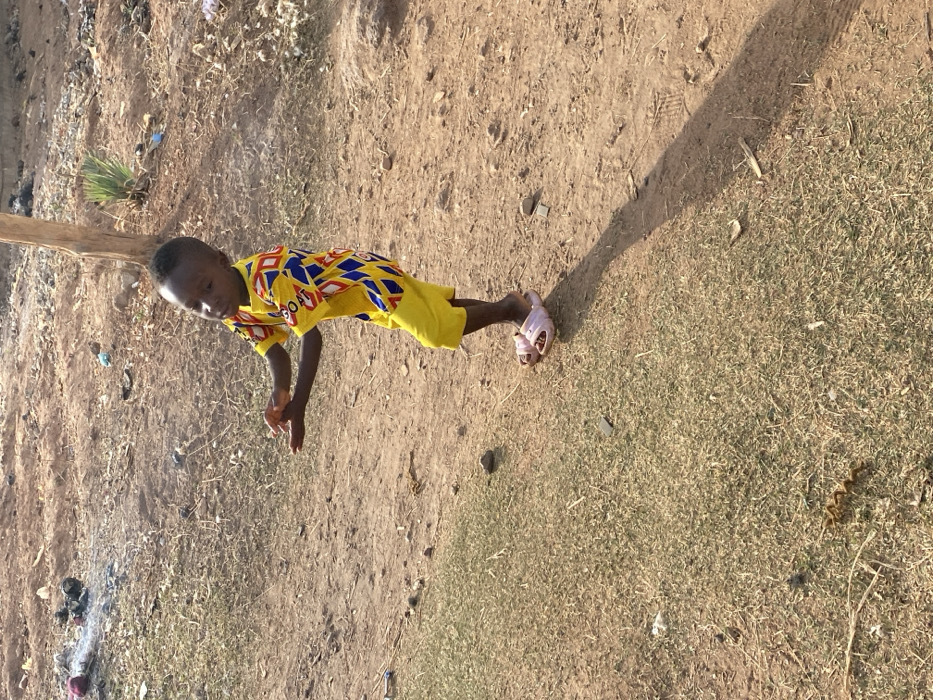 A young child stands on an uneven, light brown dirt ground interspersed with dry grass in an outdoor area of Rido, Nigeria. The child, identifiable as having dark skin and short dark hair, is clad in a yellow short-sleeved shirt featuring blue, red, and white diamond patterns, yellow shorts, and light pink open-toed slides. The child's body is slightly angled, with the head tilted upwards and to the left, and both hands are raised approximately to chest height, palms open and fingers slightly curled, indicating an ongoing action or gesture. A distinct, elongated shadow extends from the child's feet towards the lower right of the frame, suggesting a low sun angle. In the upper left background, a small accumulation of dark debris emits a faint wisp of smoke. A slender, light-colored wooden post or tree trunk is visible vertically behind the child to the right. The ground contains scattered small stones, dry organic matter, and various small pieces of litter.