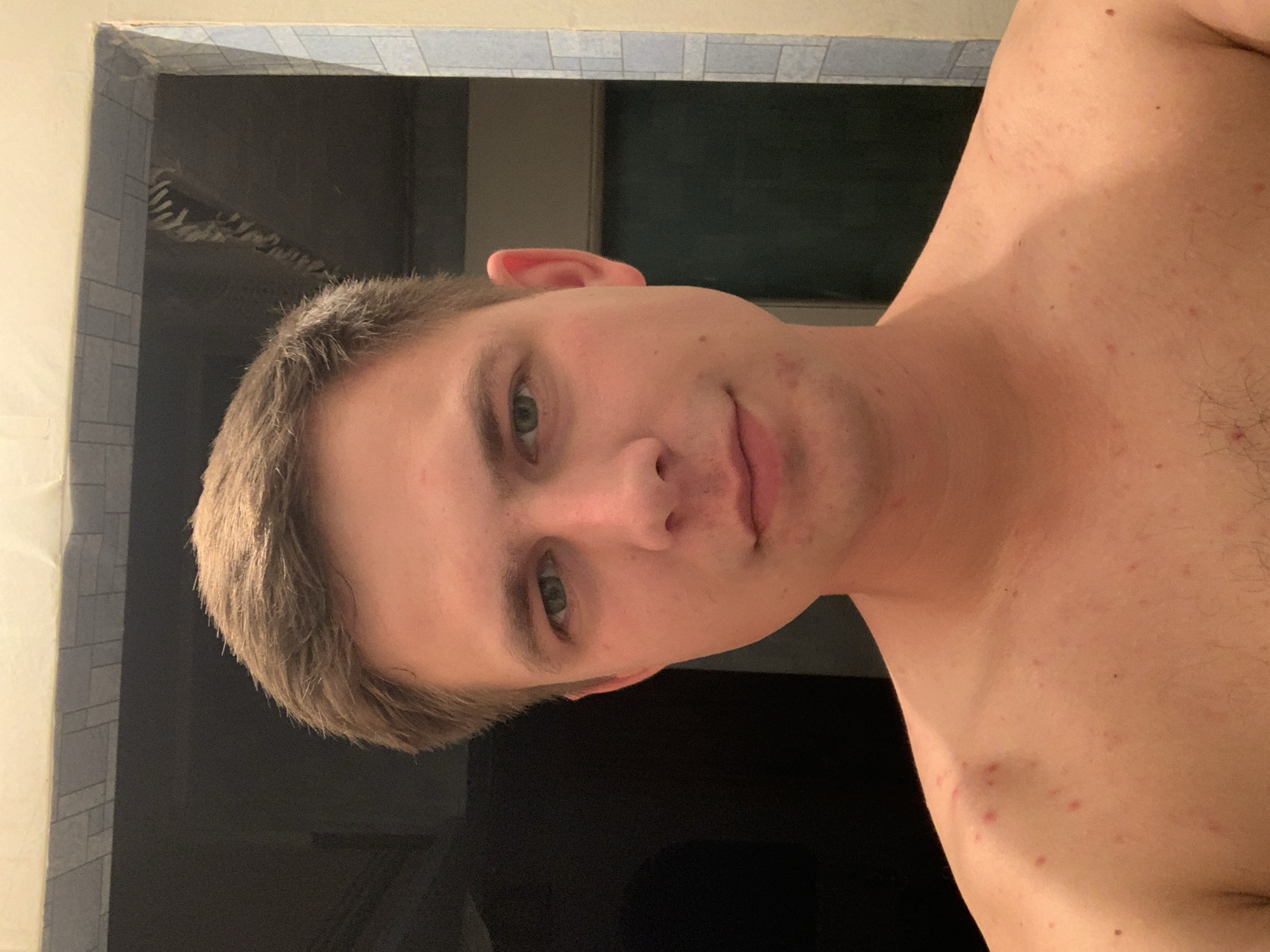 A young Caucasian man with short brown hair and green eyes is pictured from the chest up, facing the camera. He has a fair complexion with some redness on his chest and shoulders, possibly due to acne or a rash. The background appears to be a bathroom, with tiled walls and a dark opening to another room. The lighting is somewhat dim, creating shadows on his face and body.