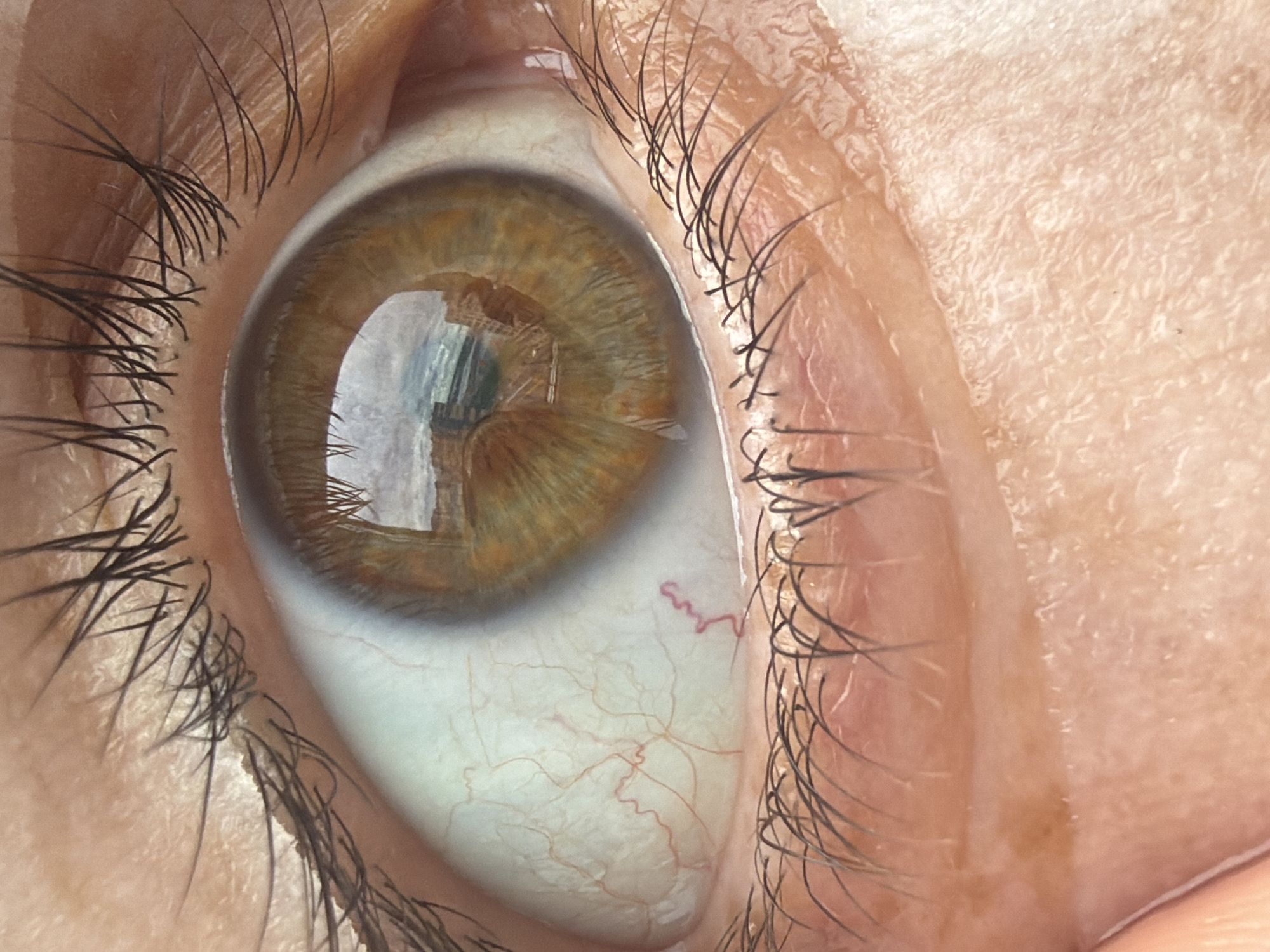 An extreme close-up of a human eye, primarily focusing on the iris, sclera, and surrounding eyelashes and skin. The iris is a hazel color with variations of brown and gold. The sclera, or white part of the eye, shows visible blood vessels. The skin around the eye appears light-skinned with fine details. The eye appears to be reflecting an environment with high-rise buildings, most likely a city environment, but the specifics are difficult to discern. The location appears to be a city of Unknown, Unknown.