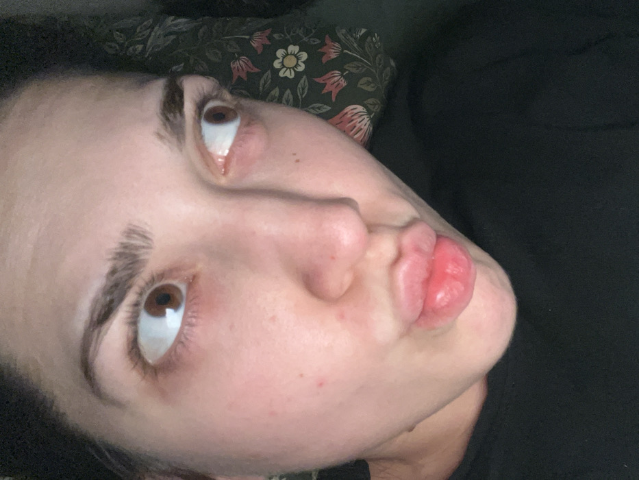 The image presents a close-up, angled view of a person's face, primarily from the nose upwards, with lips prominently featured to the right. The person has fair skin, dark brown eyes that are rolled upwards, and thick, dark eyebrows. Their lips are pursed and puckered, forming a "kissing" or "duck" face. A few small, reddish spots are visible on the cheek and around the nose.
Behind the person's head, a dark fabric with a floral pattern of white, pink, and red flowers and green leaves is visible, suggesting a pillow or a piece of bedding. To the right of the face, a plain, dark fabric, likely clothing or another part of the bedding, fills the background.
The subject appears to be lying down or reclining indoors. The upward gaze and puckered lips suggest a playful or expressive pose. There is no visible text in the image. The image was taken in Schiltigheim, France.