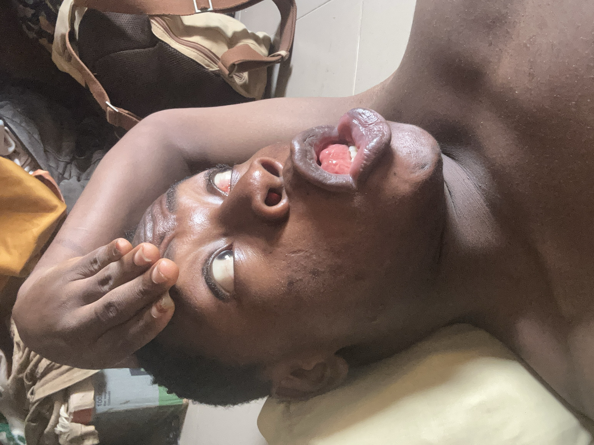 A person with dark skin is lying down, head tilted back, with their mouth open, revealing the tongue and teeth. One hand is raised near the face. A bag with straps is visible in the background, and a light-colored surface is beneath the person's head. The location is Unknown, Unknown.