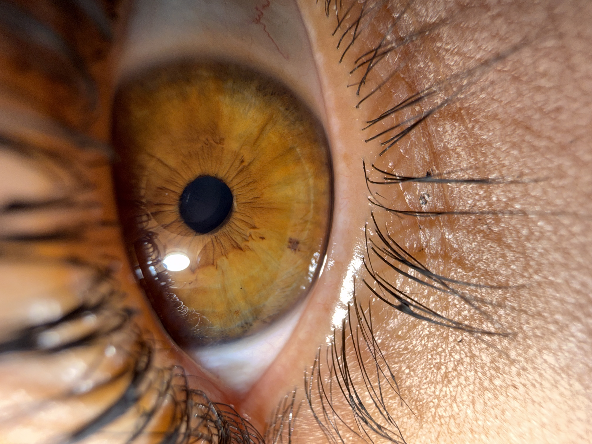 A close-up shot of a human eye fills the frame. The iris is a golden-brown color with a dark pupil. Reflections of light are visible on the surface of the eye. The surrounding skin is light brown with eyelashes. No information is present to determine its location in Votkinsk, Russia.