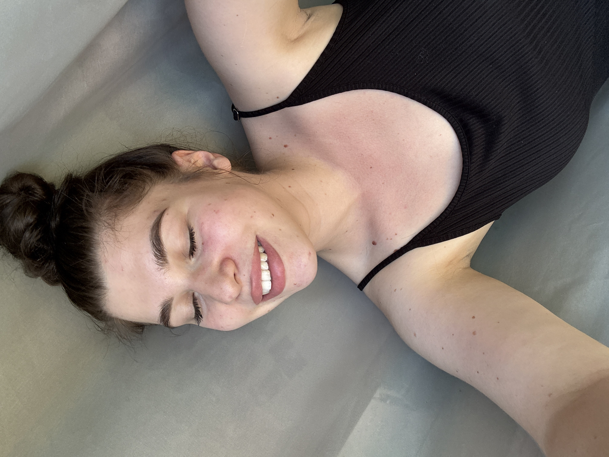 A young woman is lying on a gray surface, possibly a bed or examination table. She is wearing a black ribbed top with thin straps. Her hair is pulled back in a messy bun. She is smiling with her eyes closed, exposing her teeth. Her skin appears fair with several moles visible on her neck and arm. The background is a solid, light gray, suggesting an indoor environment. There is no indication of Мещёры, Russia, or any other specific location in the image.