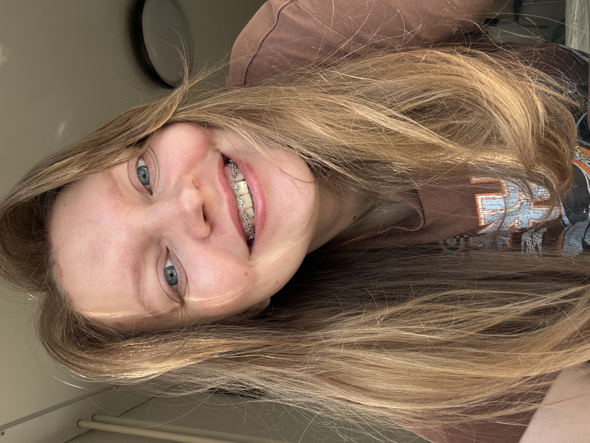 A close-up, slightly angled, indoor portrait of a young woman with long, blonde hair. She is smiling, revealing braces on her teeth. She is wearing a brown shirt. There's a light fixture visible in the background. The location is not discernible from the provided image and therefore cannot be identified as Izhevsk, Russia.