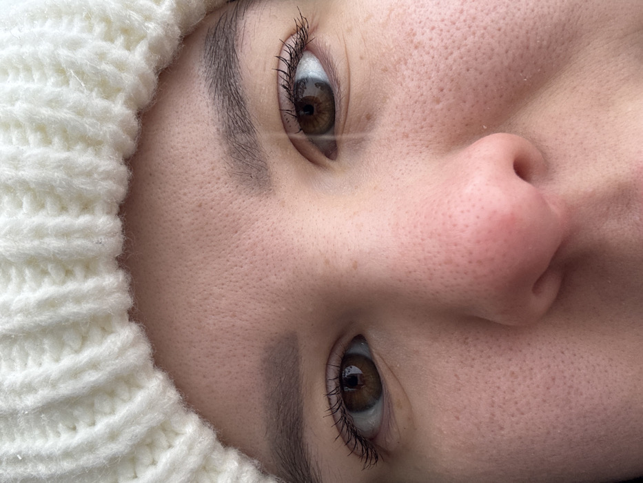 The image displays a close-up, frontal portrait of an individual's upper face, located in the city of Probuzhdenie, Russia. The subject's skin is light-toned with visible pores, and minor freckles or pigmentation spots are present on the cheeks and below the left eye. Both eyes are open, revealing brown irises, dark pupils, and eyelashes that appear to be enhanced with mascara. Dark, defined eyebrows are positioned above each eye. The upper portion of the nose, including the bridge and tip, is visible centrally below the eyes. A cream-colored, ribbed knitted hat, exhibiting small reflective specks consistent with ice or lint, covers the subject's forehead and the top of the head. Lighting appears natural and diffuse. A subtle vertical light streak is present across the right eye.