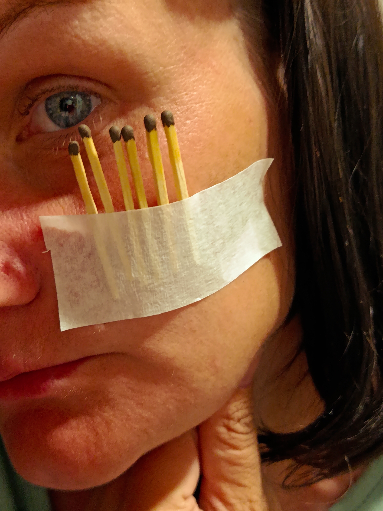 A close-up photograph captures a portion of a person's face. The subject's left eye, which is blue, is visible at the top left. A piece of white tape is affixed to the face, running diagonally from below the eye towards the cheek. Embedded within the tape are several wooden matches, positioned vertically. The matches have yellow shafts and dark brown heads. The skin tone of the individual is fair. Dark brown hair is visible at the right edge of the image. A hand touches the subject's face near the chin.